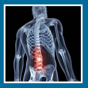 chronic lower back pain sciatica Richmond VA